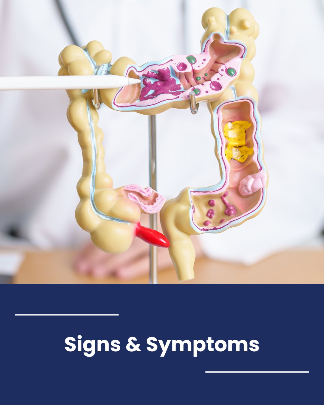 Colon cancer doesn’t always show symptoms early. Watch for blood in stool, changes in bowel habits, abdominal pain, fatigue, or unexplained weight loss. Early detection matters.